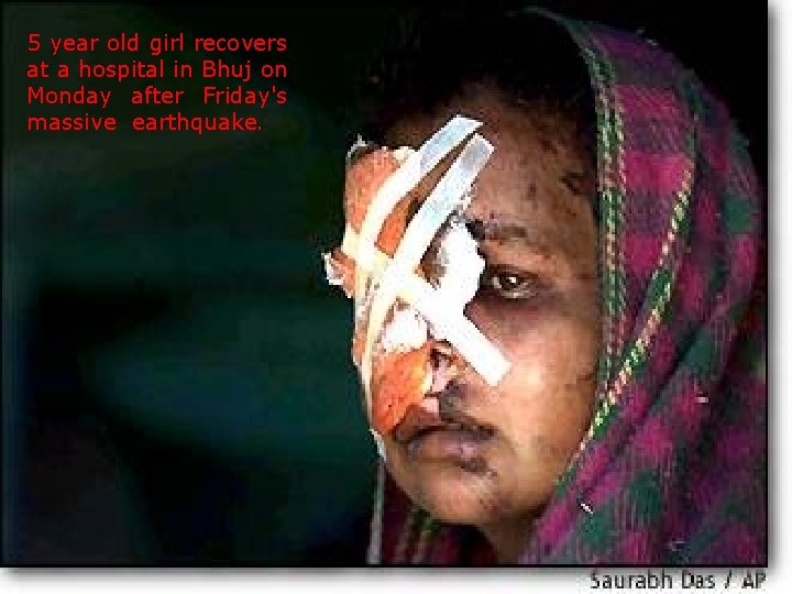 5 year old girl recovers at a hospital in Bhuj on Monday after Friday's
