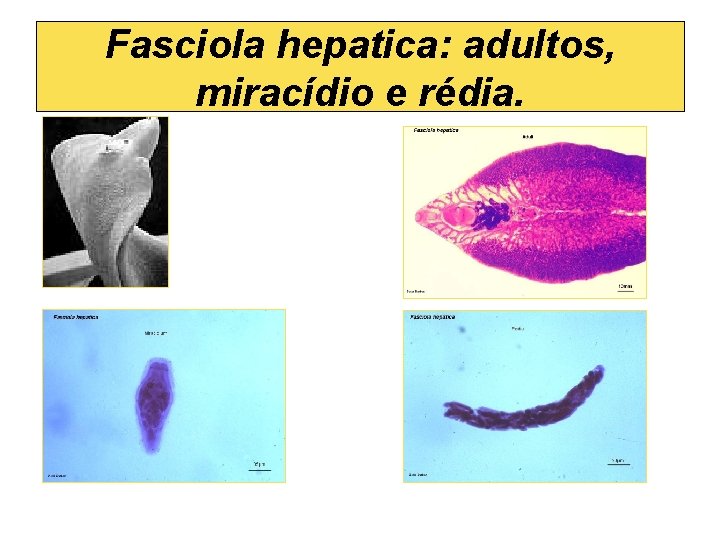 Fasciola hepatica: adultos, miracídio e rédia. 
