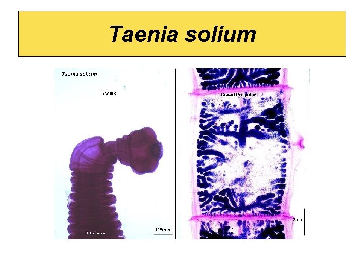 Taenia solium 