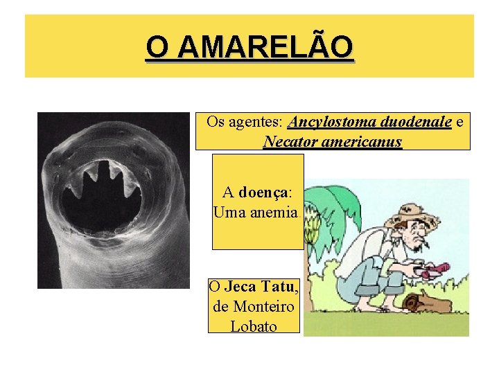 O AMARELÃO Os agentes: Ancylostoma duodenale e Necator americanus A doença: Uma anemia. O