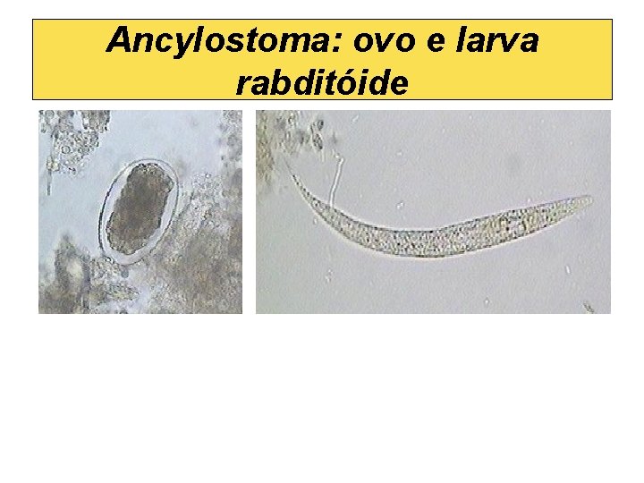 Ancylostoma: ovo e larva rabditóide 