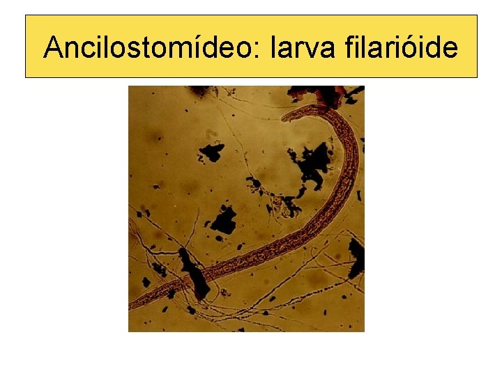 Ancilostomídeo: larva filarióide 