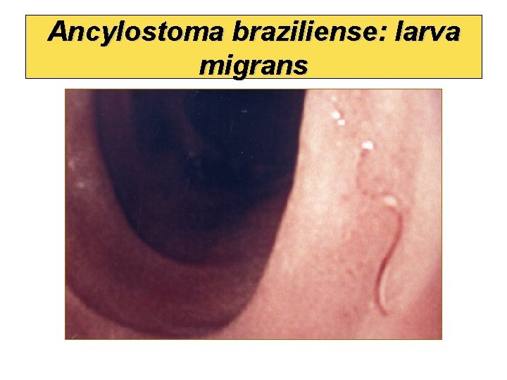 Ancylostoma braziliense: larva migrans 