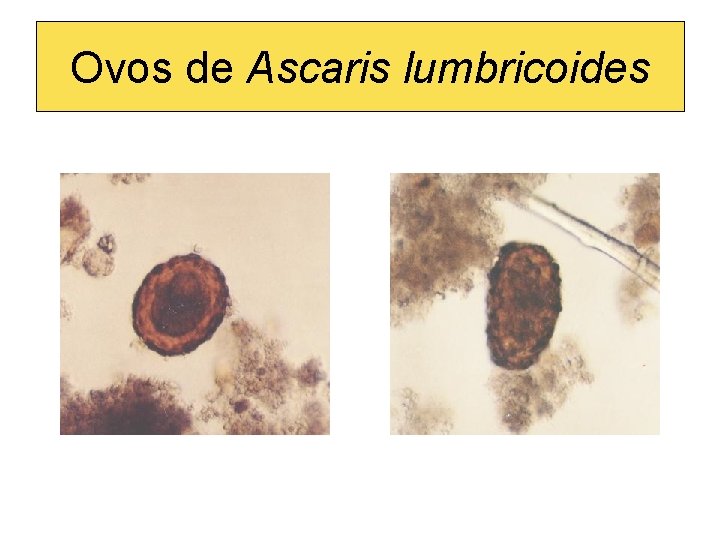 Ovos de Ascaris lumbricoides 