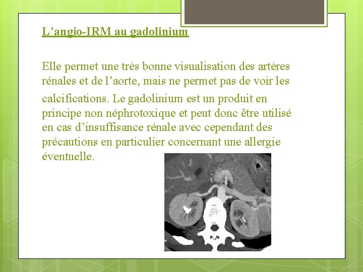 L’angio-IRM au gadolinium Elle permet une très bonne visualisation des artères rénales et de