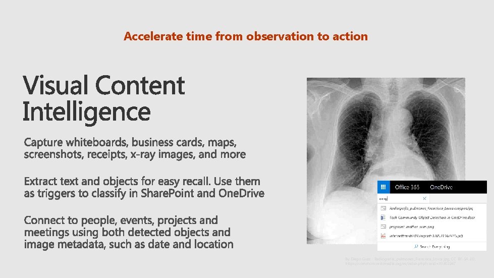 Accelerate time from observation to action By Diego Grez - Radiografía_pulmones_Francisca_Lorca. jpg, CC BY-SA