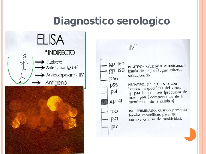 Diagnostico serologico 