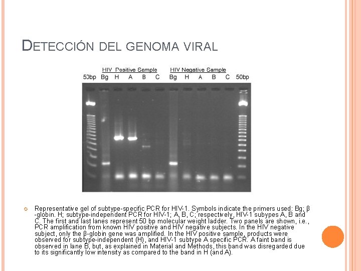 DETECCIÓN DEL GENOMA VIRAL Representative gel of subtype-specific PCR for HIV-1. Symbols indicate the