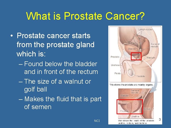 What is Prostate Cancer? • Prostate cancer starts from the prostate gland which is: