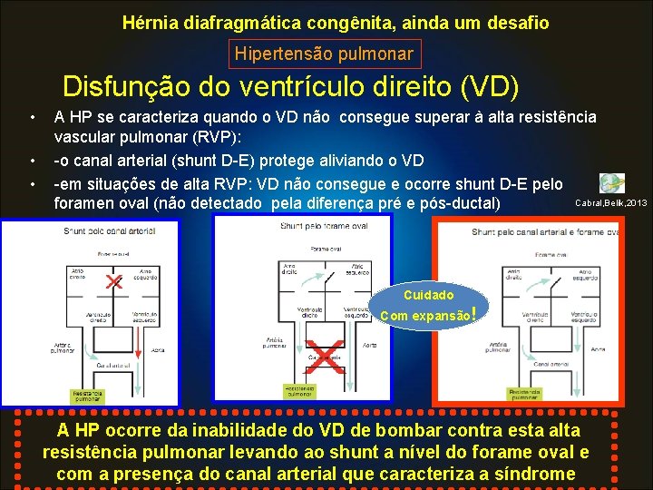 Hérnia diafragmática congênita, ainda um desafio Hipertensão pulmonar Disfunção do ventrículo direito (VD) •