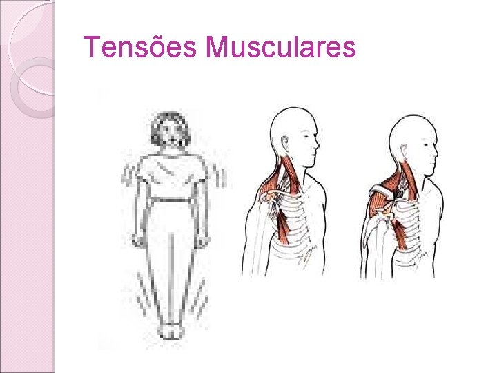 Tensões Musculares Tensões Musculares