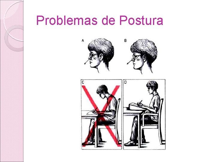 Problemas de Postura Problemas de Postura