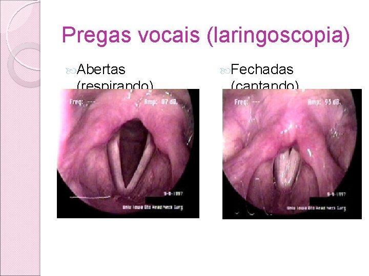 Pregas vocais (laringoscopia) Abertas (respirando) Fechadas (cantando) Pregas vocais (laringoscopia) Abertas (respirando) Fechadas (cantando)