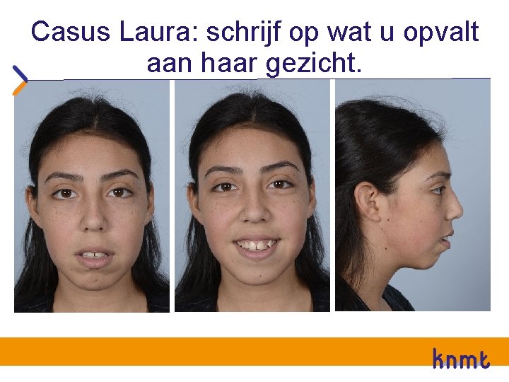 Casus Laura: schrijf op wat u opvalt aan haar gezicht. 