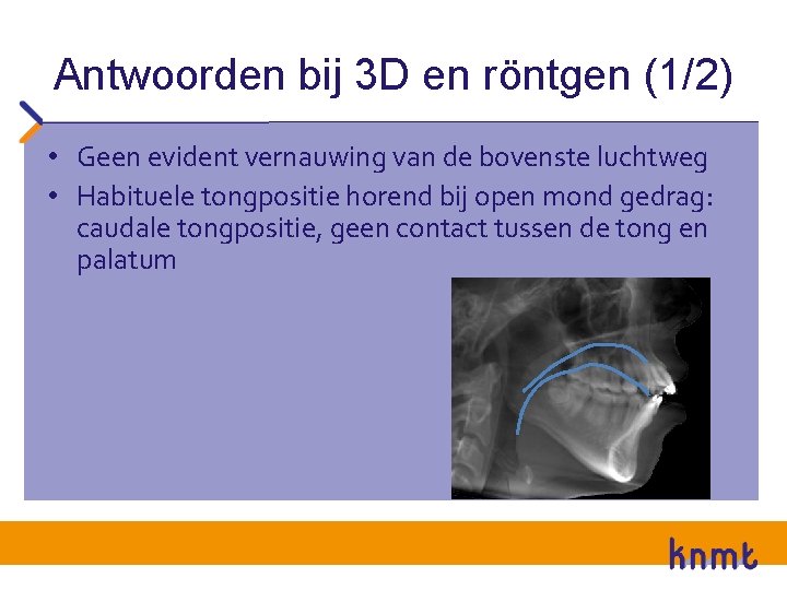 Antwoorden bij 3 D en röntgen (1/2) • Geen evident vernauwing van de bovenste