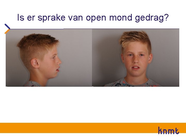 Is er sprake van open mond gedrag? Is er sprake van open mond gedrag?