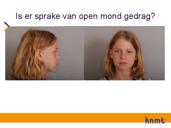 Is er sprake van open mond gedrag? Is er sprake van open mond gedrag?