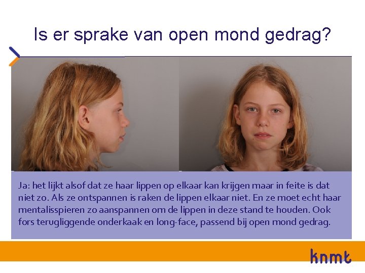 Is er sprake van open mond gedrag? Ja: het lijkt alsof dat ze haar