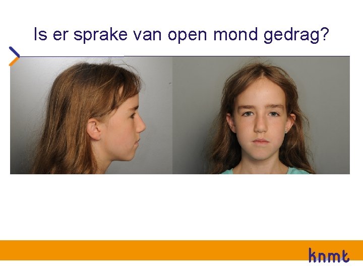 Is er sprake van open mond gedrag? Is er sprake van open mond gedrag?
