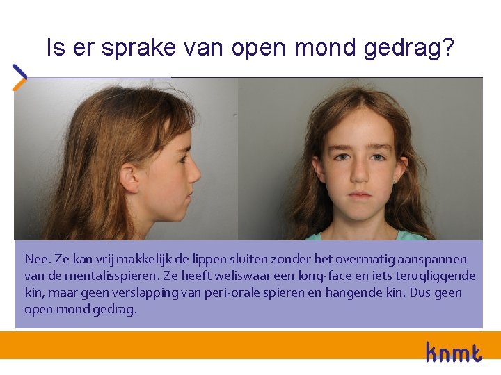 Is er sprake van open mond gedrag? Nee. Ze kan vrij makkelijk de lippen Is er sprake van open mond gedrag? Nee. Ze kan vrij makkelijk de lippen