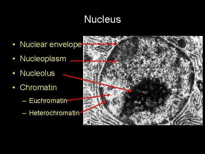 Nucleus • Nuclear envelope • Nucleoplasm • Nucleolus • Chromatin – Euchromatin – Heterochromatin