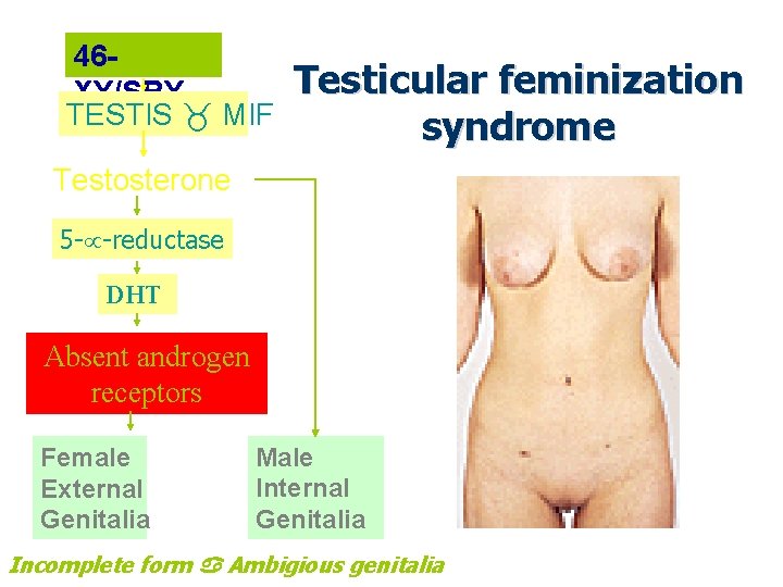 46 XY/SRY TESTIS MIF Testicular feminization syndrome Testosterone 5 - -reductase DHT Absent androgen