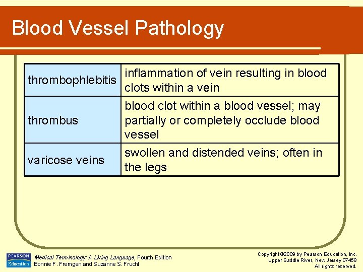 Blood Vessel Pathology thrombophlebitis thrombus varicose veins inflammation of vein resulting in blood clots