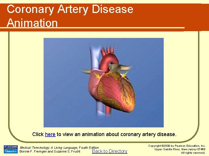 Coronary Artery Disease Animation Click here to view an animation about coronary artery disease.