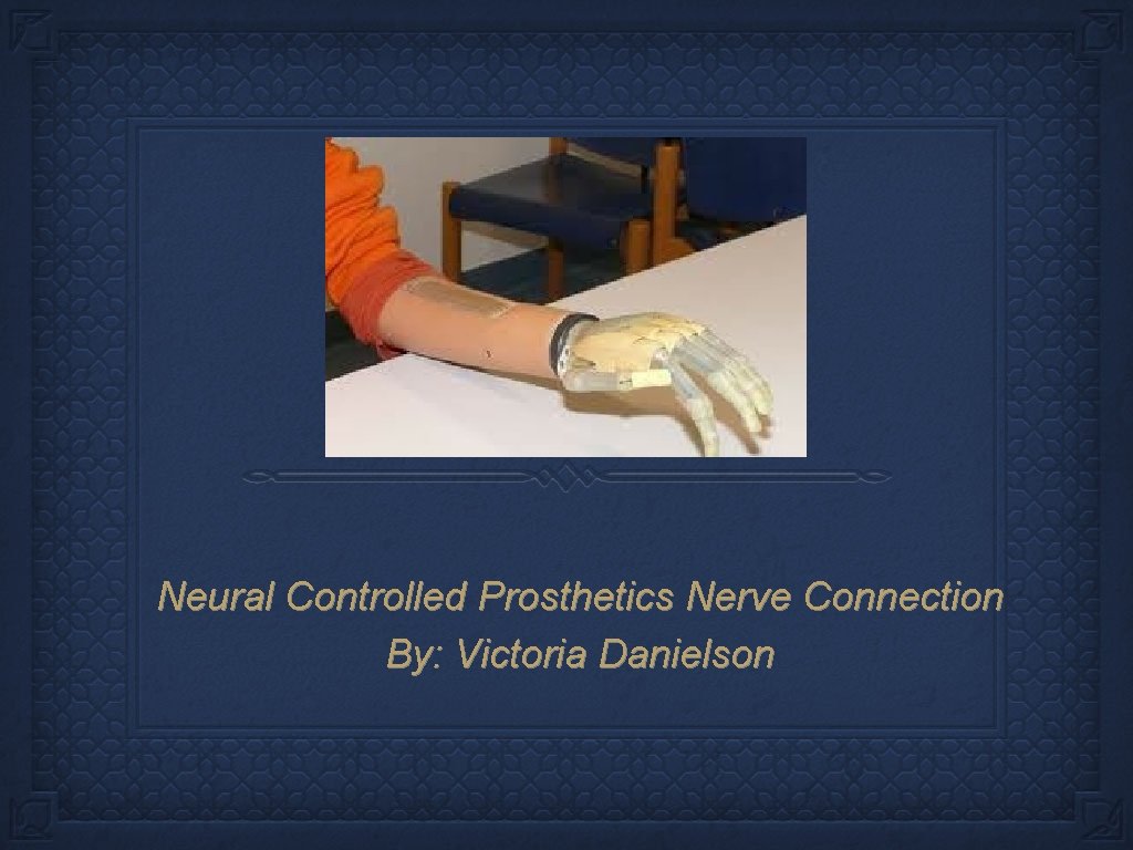 Neural Controlled Prosthetics Nerve Connection By: Victoria Danielson 