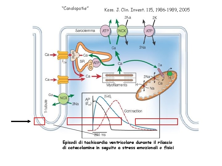 “Canalopatie” Kass. J. Clin. Invest. 115, 1986 -1989, 2005 Episodi di tachicardia ventricolare durante