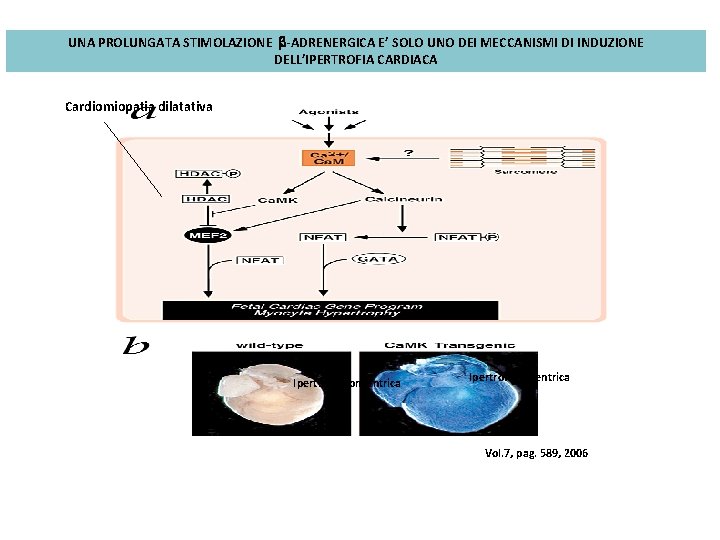 UNA PROLUNGATA STIMOLAZIONE b-ADRENERGICA E’ SOLO UNO DEI MECCANISMI DI INDUZIONE DELL’IPERTROFIA CARDIACA Cardiomiopatia