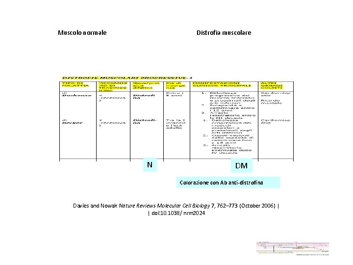 Muscolo normale Distrofia muscolare N DM Colorazione con Ab anti-distrofina Davies and Nowak Nature