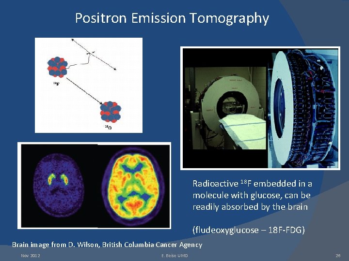 Positron Emission Tomography Radioactive 18 F embedded in a molecule with glucose, can be