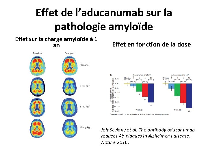 Effet de l’aducanumab sur la pathologie amyloïde Effet sur la charge amyloïde à 1