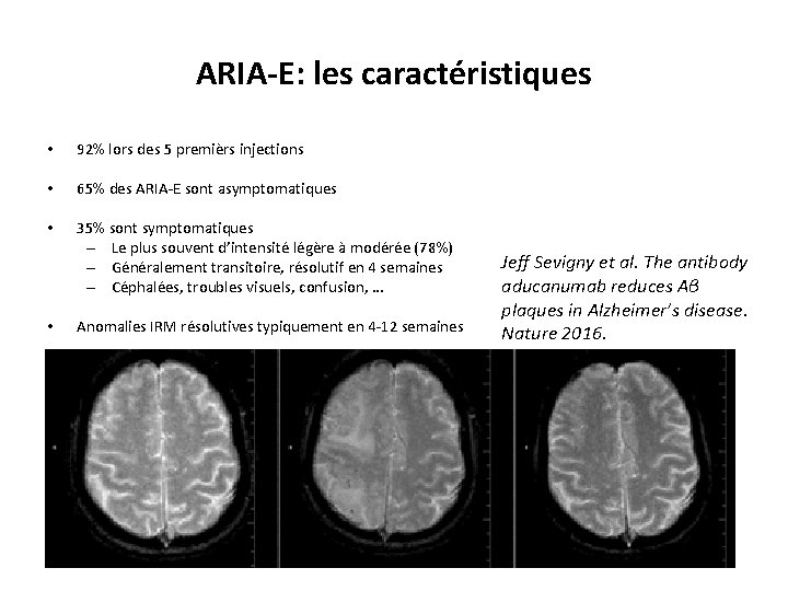 ARIA-E: les caractéristiques • 92% lors des 5 premièrs injections • 65% des ARIA-E