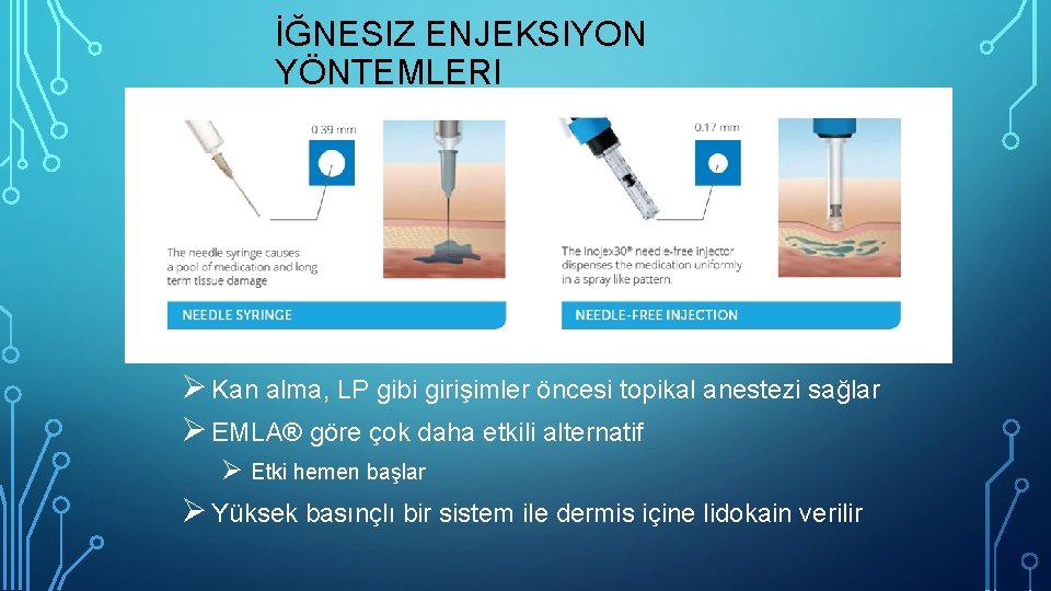 İĞNESIZ ENJEKSIYON YÖNTEMLERI Ø Kan alma, LP gibi girişimler öncesi topikal anestezi sağlar Ø