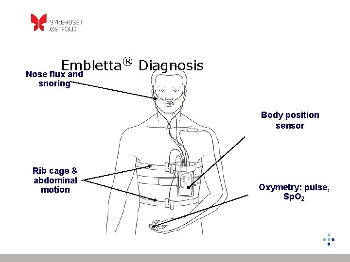 Embletta® Diagnosis Nose flux and snoring Body position sensor Rib cage & abdominal motion