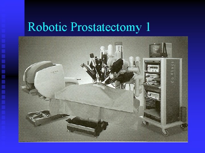 Robotic Prostatectomy 1 Robotic Prostatectomy 1