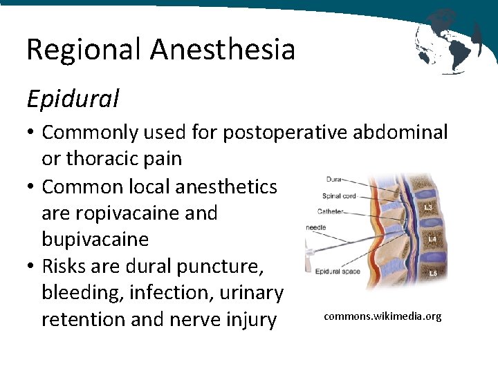 Regional Anesthesia Epidural • Commonly used for postoperative abdominal or thoracic pain • Common