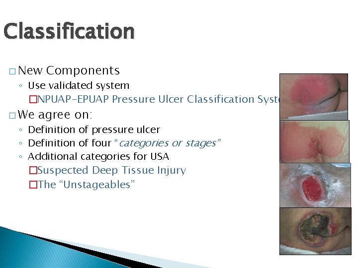 Classification � New Components ◦ Use validated system �NPUAP-EPUAP Pressure Ulcer Classification System �