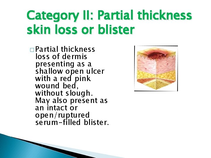 Category II: Partial thickness skin loss or blister � Partial thickness loss of dermis