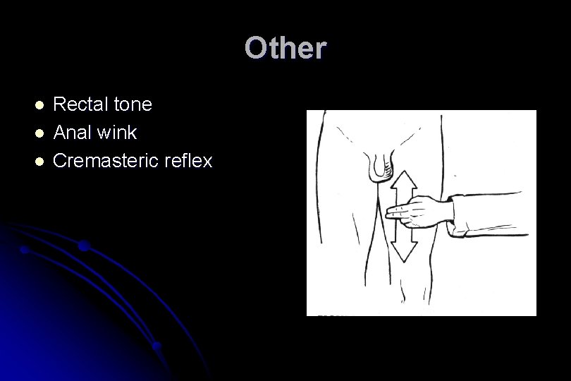 What Is An Anal Wink Test