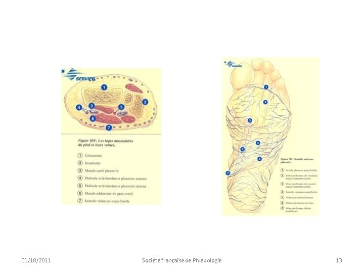 01/10/2011 Société française de Phlébologie 13 