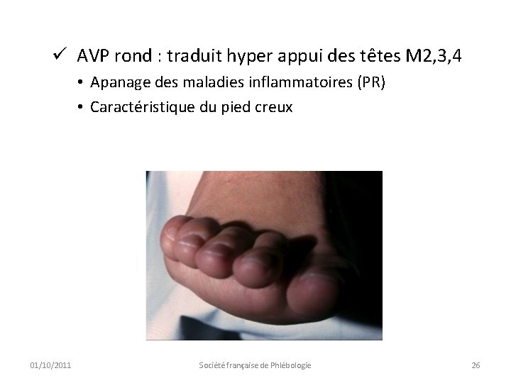 ü AVP rond : traduit hyper appui des têtes M 2, 3, 4 •