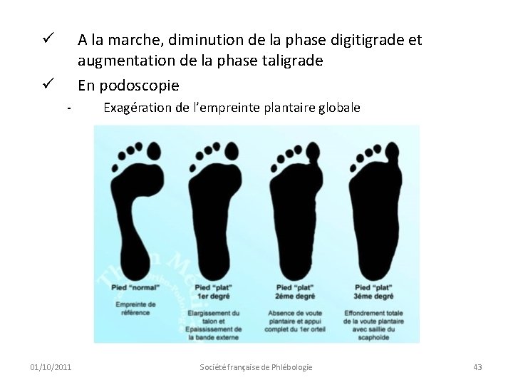 A la marche, diminution de la phase digitigrade et augmentation de la phase taligrade