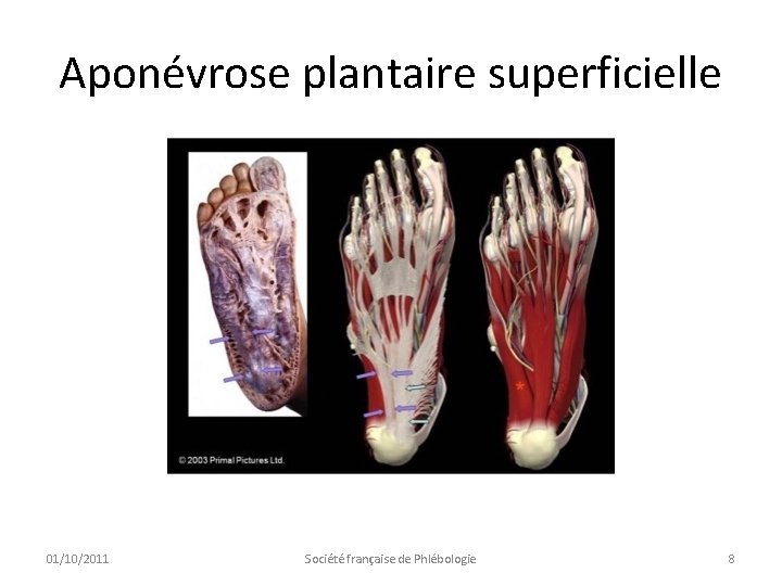 Aponévrose plantaire superficielle 01/10/2011 Société française de Phlébologie 8 