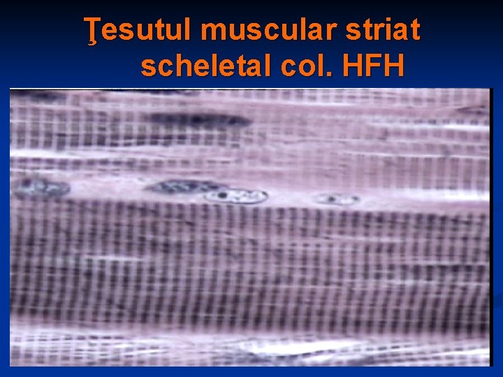 Ţesutul muscular striat scheletal col. HFH 