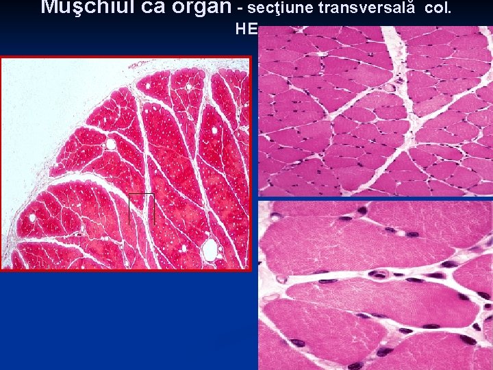 Muşchiul ca organ - secţiune transversală HE col. 