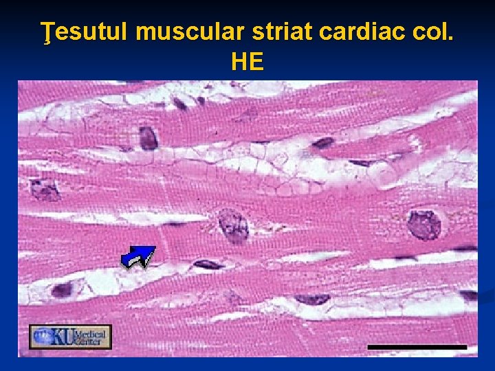 Ţesutul muscular striat cardiac col. HE 