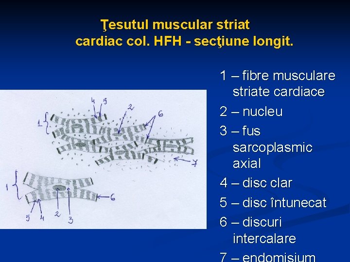 Ţesutul muscular striat cardiac col. HFH - secţiune longit. 1 – fibre musculare striate